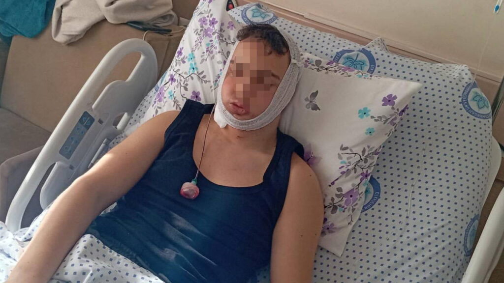 Eskişehir’de Liseliye Yapılan Saldırı Davasında 4 Sanığın Tahliyesi